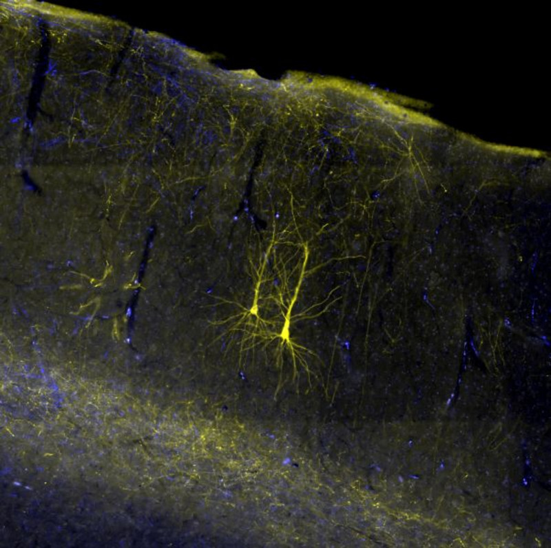 Zwei Nervenzellen im Gehirn eines Rhesusaffen, die mit einem gelben Fluoreszenzfarbstoff sichtbar gemacht wurden. Foto: Michael Fortuna