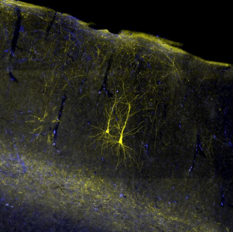 Zwei Nervenzellen im Gehirn eines Rhesusaffen, die mit einem gelben Fluoreszenzfarbstoff sichtbar gemacht wurden. Foto: Michael Fortuna Zwei Nervenzellen im Gehirn eines Rhesusaffen, die mit einem gelben Fluoreszenzfarbstoff sichtbar gemacht wurden. Foto: Michael Fortuna